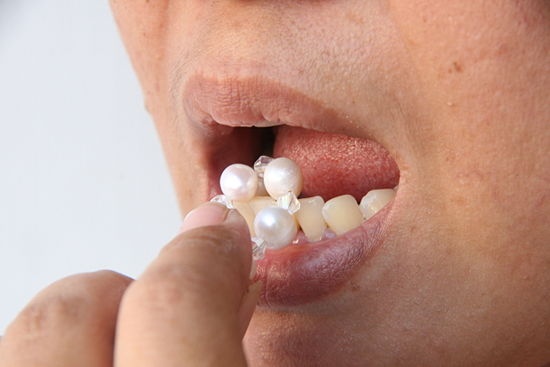 Chà sát viên ngọc trai vào các răng ở phía trước hàm